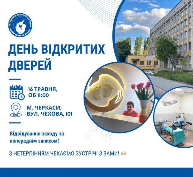 День відкритих дверей ЧМПБ
