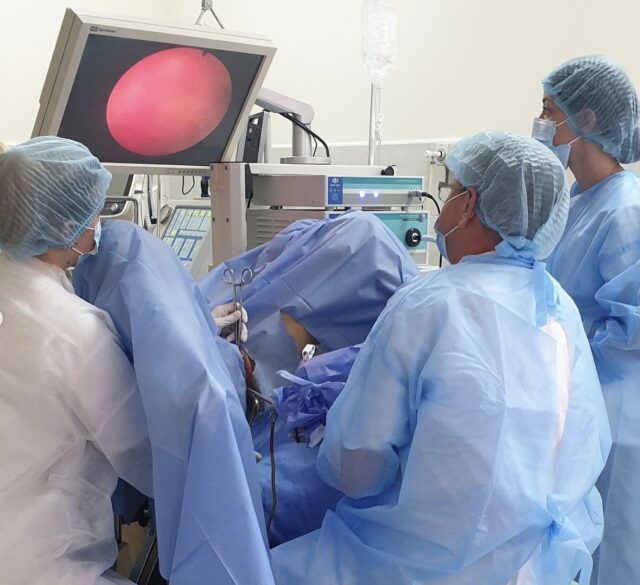 Лапароскопія