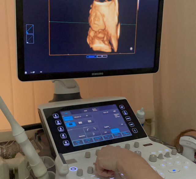УЗД вагітності