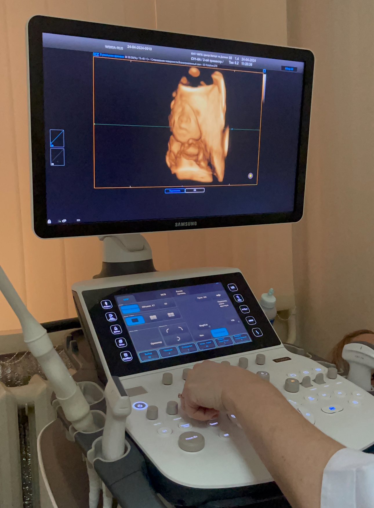 УЗД вагітності